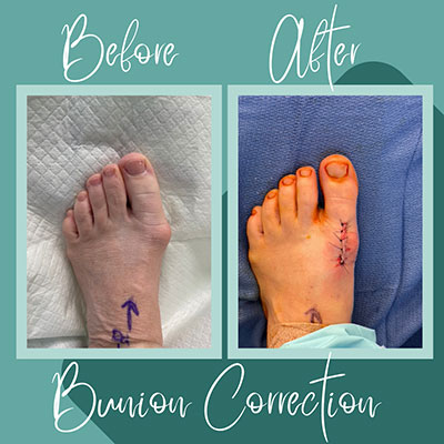 before and after