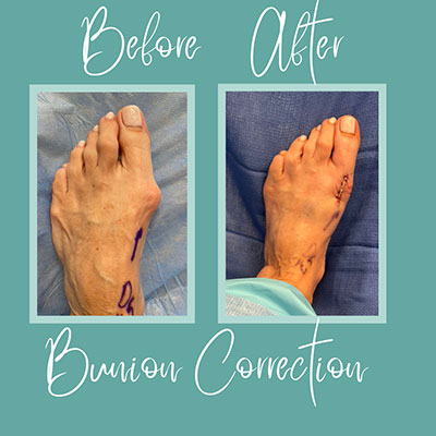 before and after