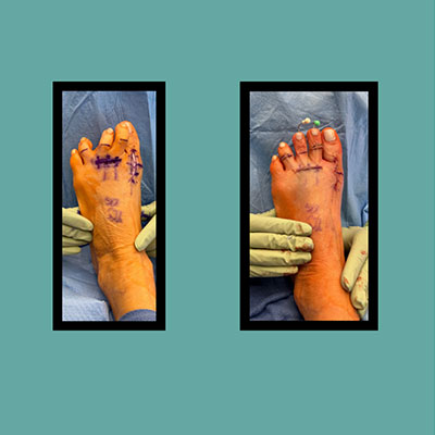 before and after