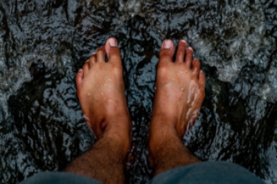 Living With a Hammertoe