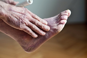 Key Facts About Poor Foot Circulation