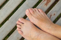 Causes of Hammertoe