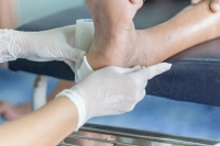 Foot Wounds and Diabetes