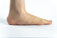 Problematic Flat Feet